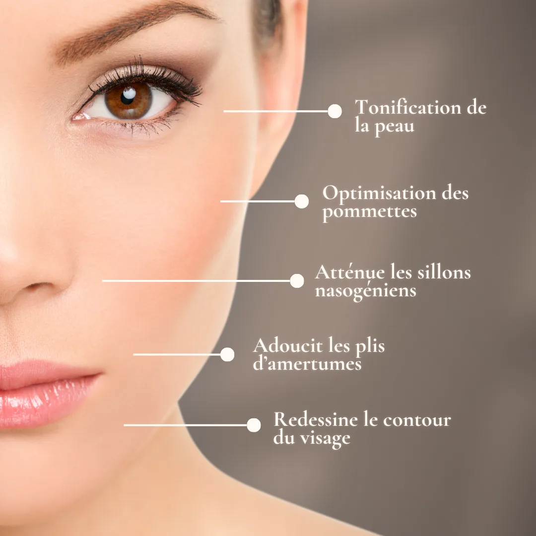 Les fils tenseurs est un type de procédure dans lequel des fils temporaires sont utilisés pour produire un lifting du visage sans chirurgie et sans cicatrices.